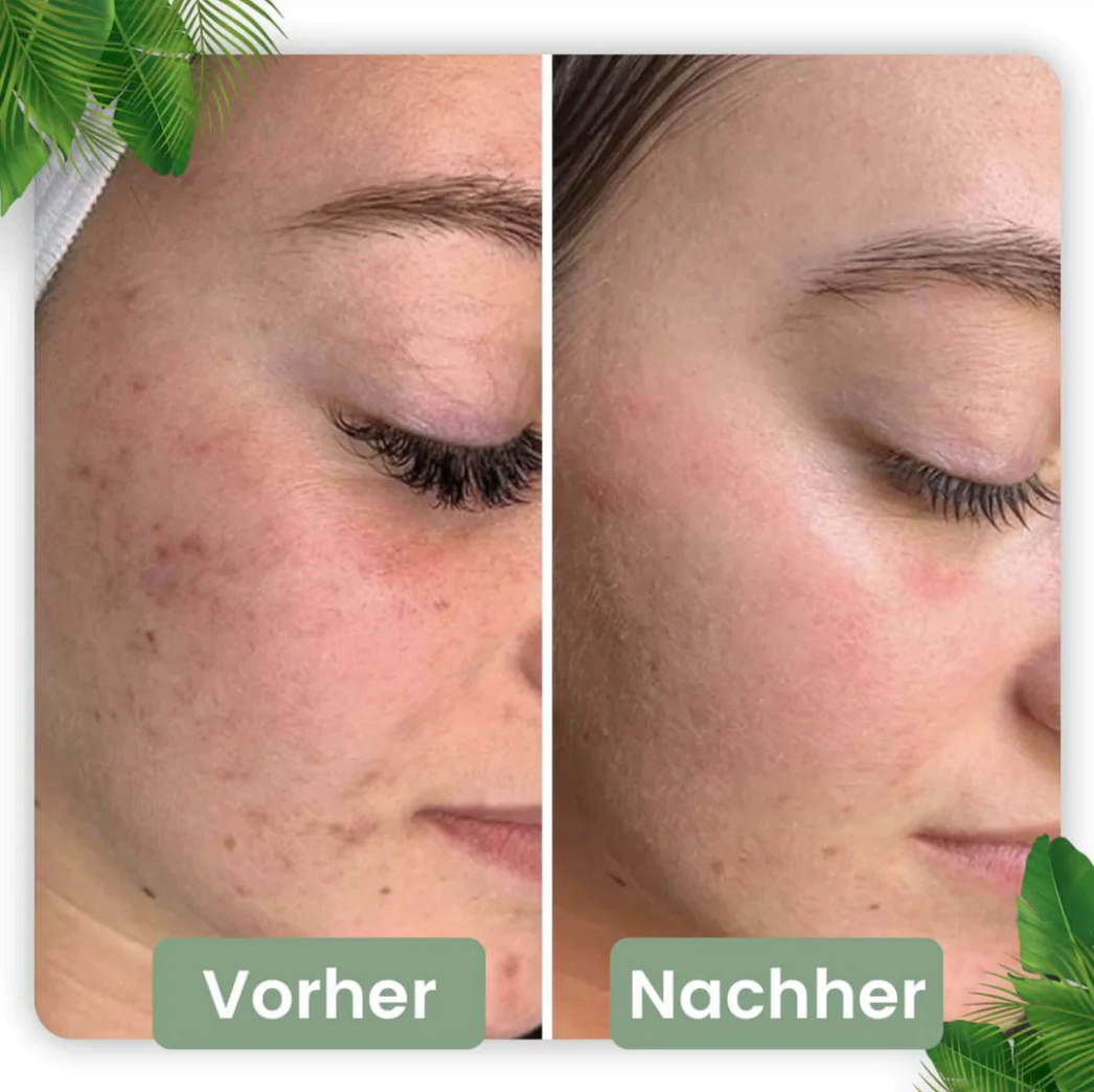 Reinigungsmaske Stick für Gesichtsreinigung | Naturkosmetik mit Grünteeextrakt für Hautpflege | LumiHaut
