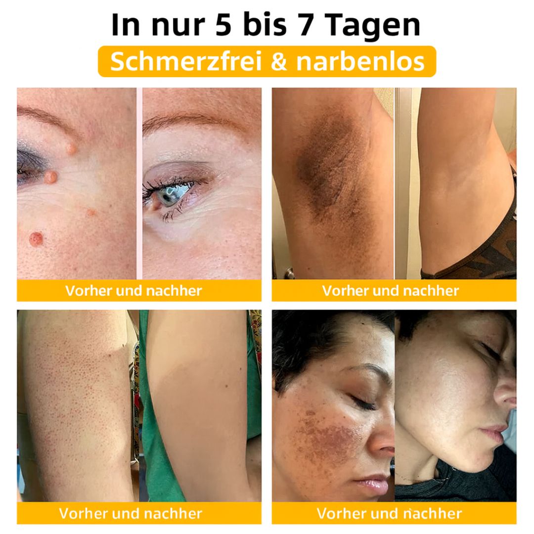 Bienengift Serum | Naturkosmetik | Spray mit Bienengift, Hyaluron & Kollagen | BeeLisse