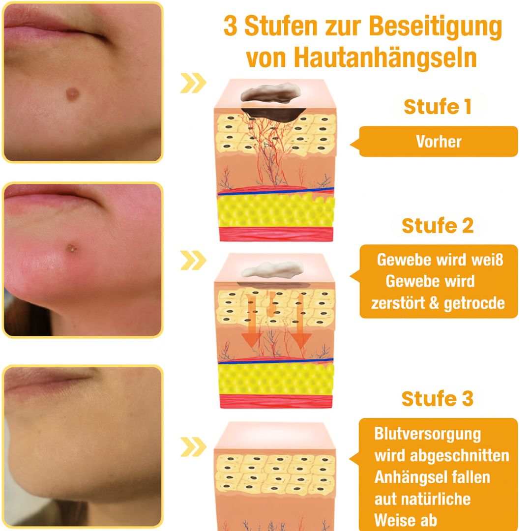 Bienengift Serum | Naturkosmetik | Spray mit Bienengift, Hyaluron & Kollagen | BeeLisse