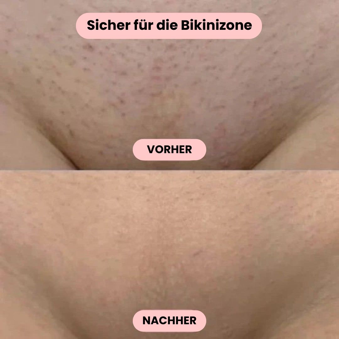 Intimrasierer Frauen | Elektrischer Rasierer für Damen | IntimLisse