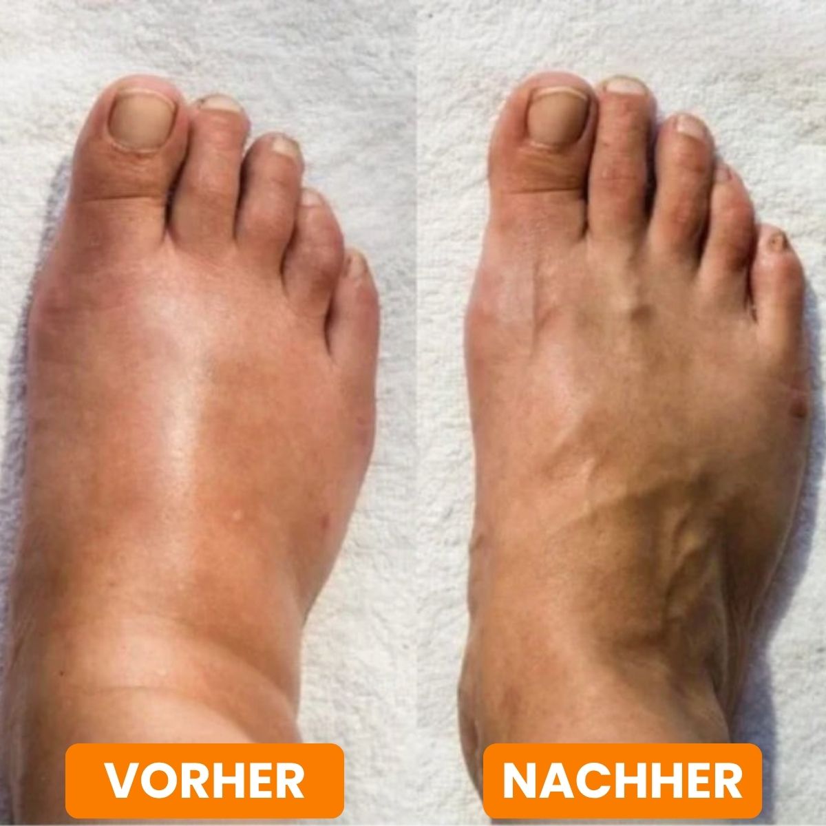 EMS-Fußmassagegerät für tiefe Entspannung | RelaxFuß