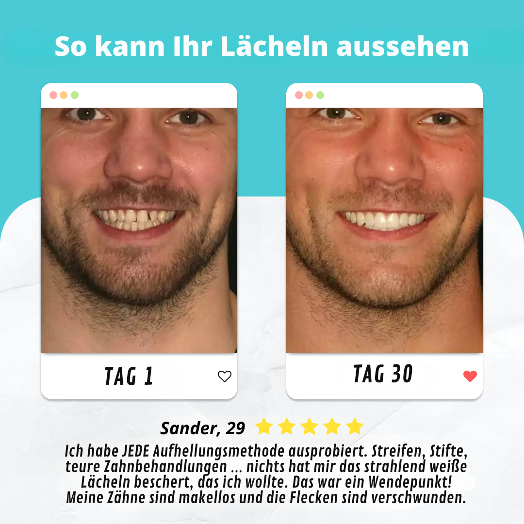 Elektrische Zahnbürste | Zahnbürste mit 360 Grad Reinigung | ZahnBlitz